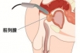 前列腺振动按摩治疗仪