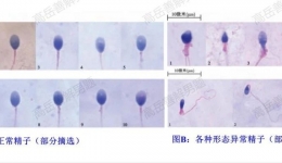 精子也有“颜值”焦虑？揭秘生命起点的“选帅”之谜！