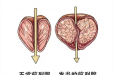 慢性前列腺炎能治愈吗？到底会不会影响生育？