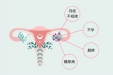 多囊卵巢综合征为何“青睐”这一女性群体？她们大多有这些特点