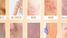 【聚焦】立足医疗本质，制定皮肤问题修护方案！——皮肤科专病专家特色门诊开诊了！